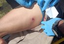 LESIONAN CON BALINES A MOTOCICLISTA EN LA TIZIMÍN-RÍO LAGARTOS