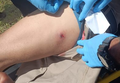 LESIONAN CON BALINES A MOTOCICLISTA EN LA TIZIMÍN-RÍO LAGARTOS