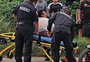 MOTOCICLISTA DERRAPA Y SUFRE POSIBLE FRACTURA EN TIZIMÍN