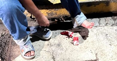 PEATÓN SE LESIONA POR ALCANTARILLA ABIERTA