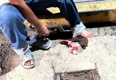 PEATÓN SE LESIONA POR ALCANTARILLA ABIERTA